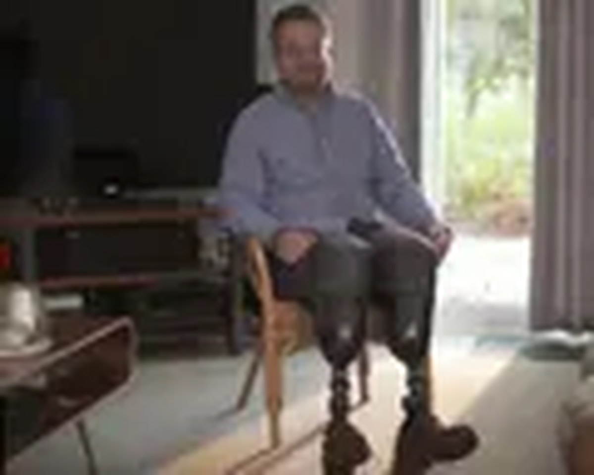 Neil Hopper amputee surgeon