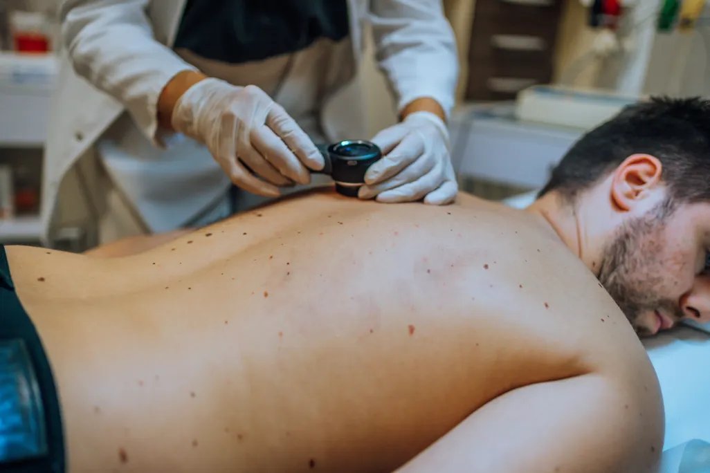 A doctor-like person looking at a man's back which is covered in moles